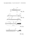 MINIMALLY INVASIVE SURGICAL STABILIZATION DEVICES AND METHODS diagram and image