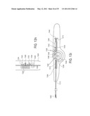 MINIMALLY INVASIVE SURGICAL STABILIZATION DEVICES AND METHODS diagram and image