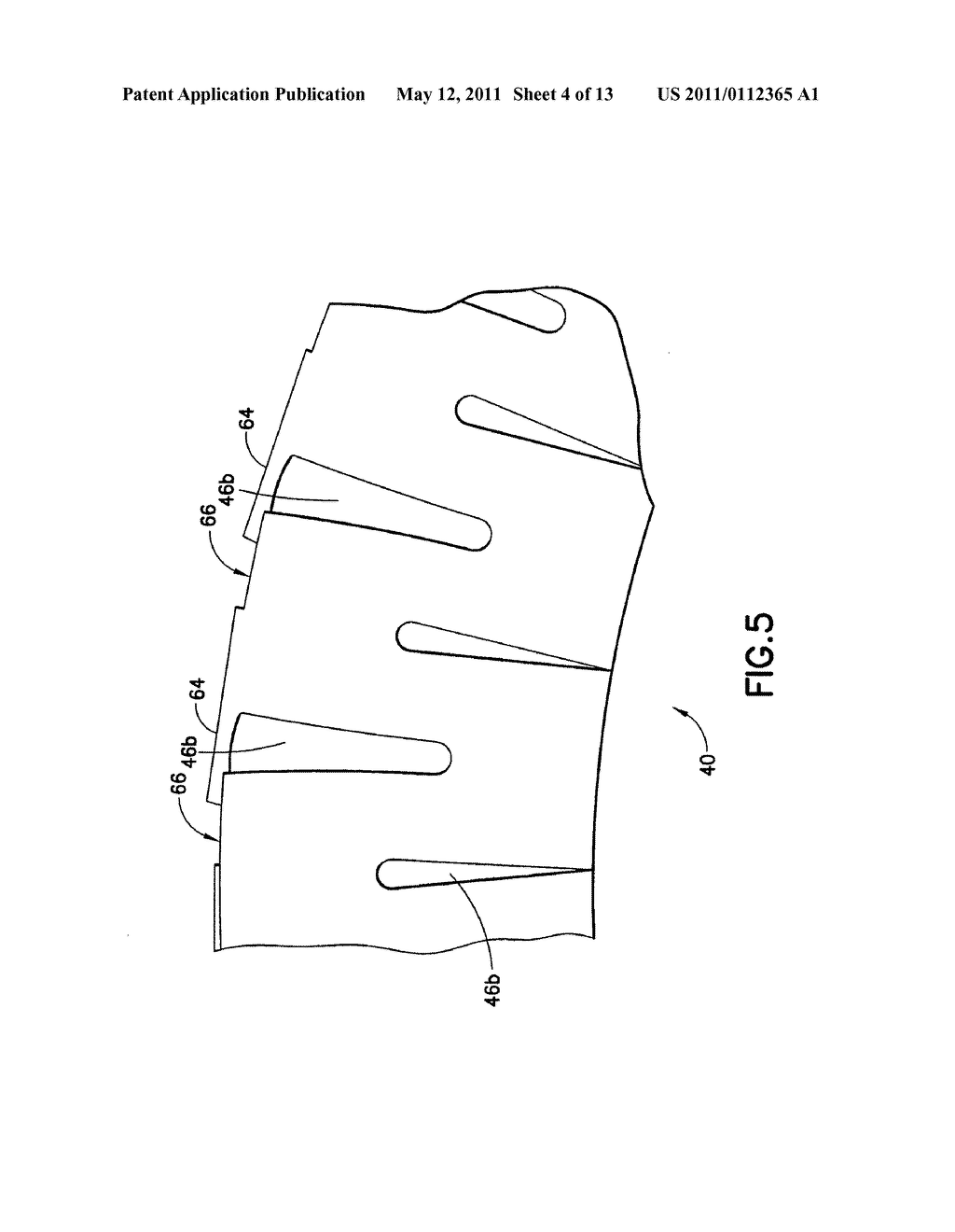 Endoscope shaft - diagram, schematic, and image 05