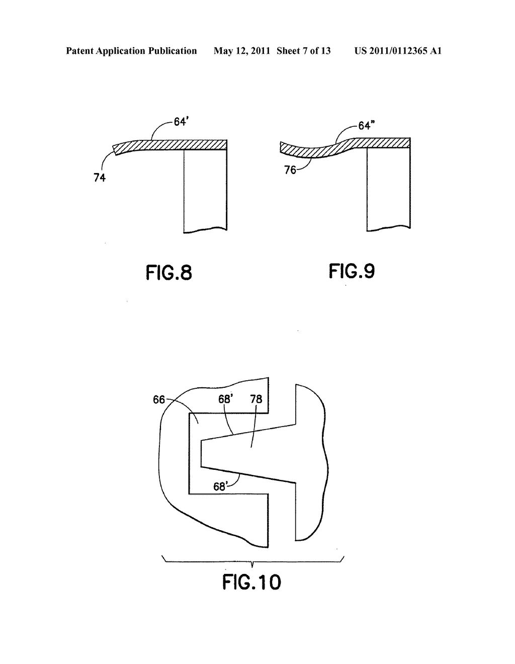 Endoscope shaft - diagram, schematic, and image 08