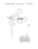 Laparoscopic instrument diagram and image