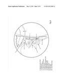 Laparoscopic instrument diagram and image