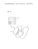 Analyte Monitoring Device and Methods of Use diagram and image