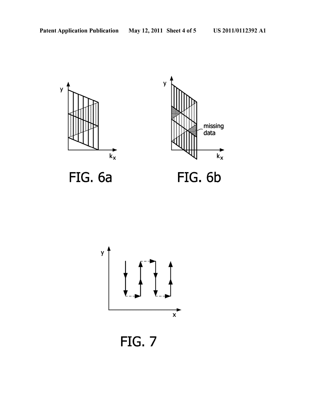 MR IMAGING WITH EXTENDED FIELD OF VIEW - diagram, schematic, and image 05