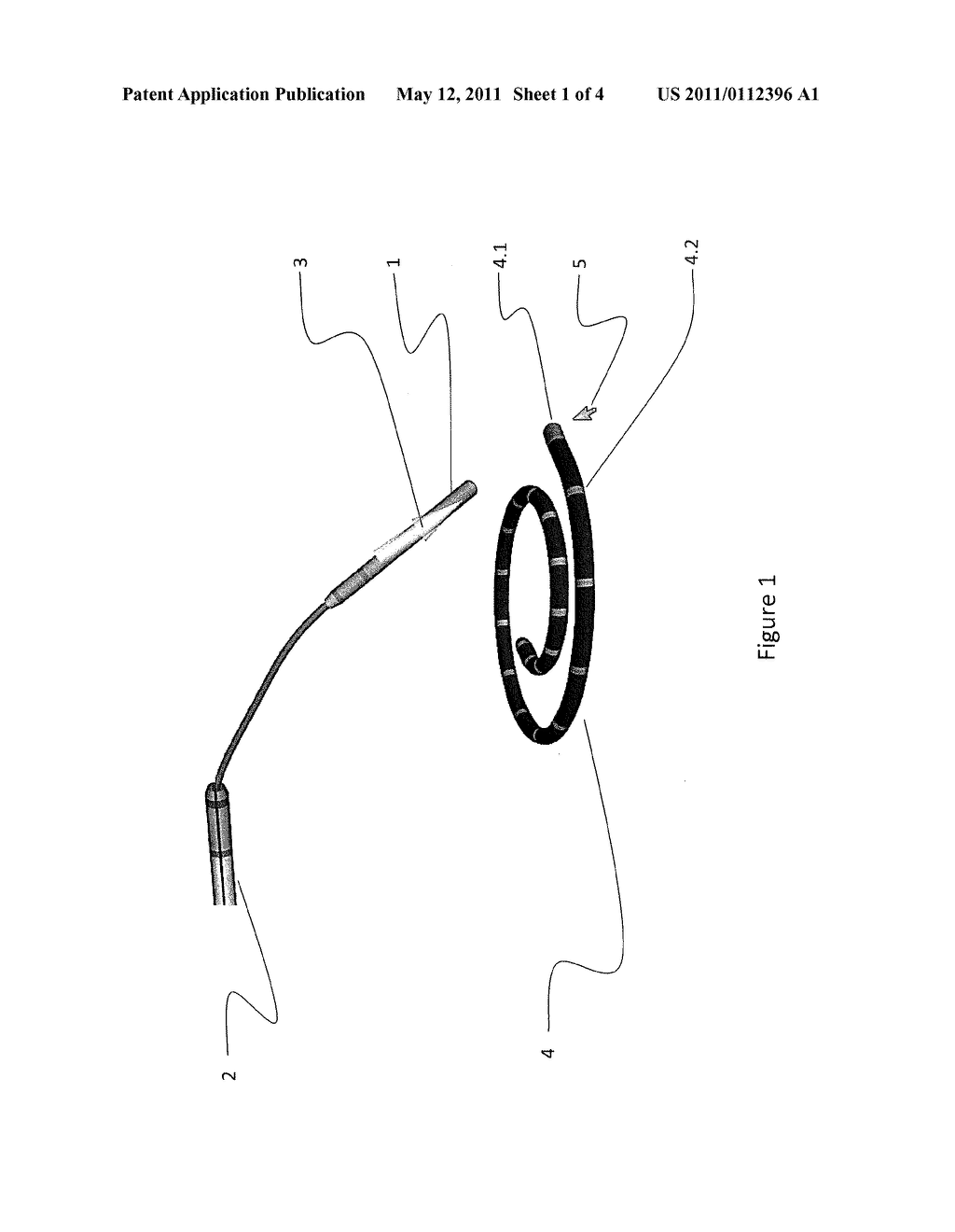 SYSTEM AND METHOD FOR TARGETING CATHETER ELECTRODES - diagram, schematic, and image 02