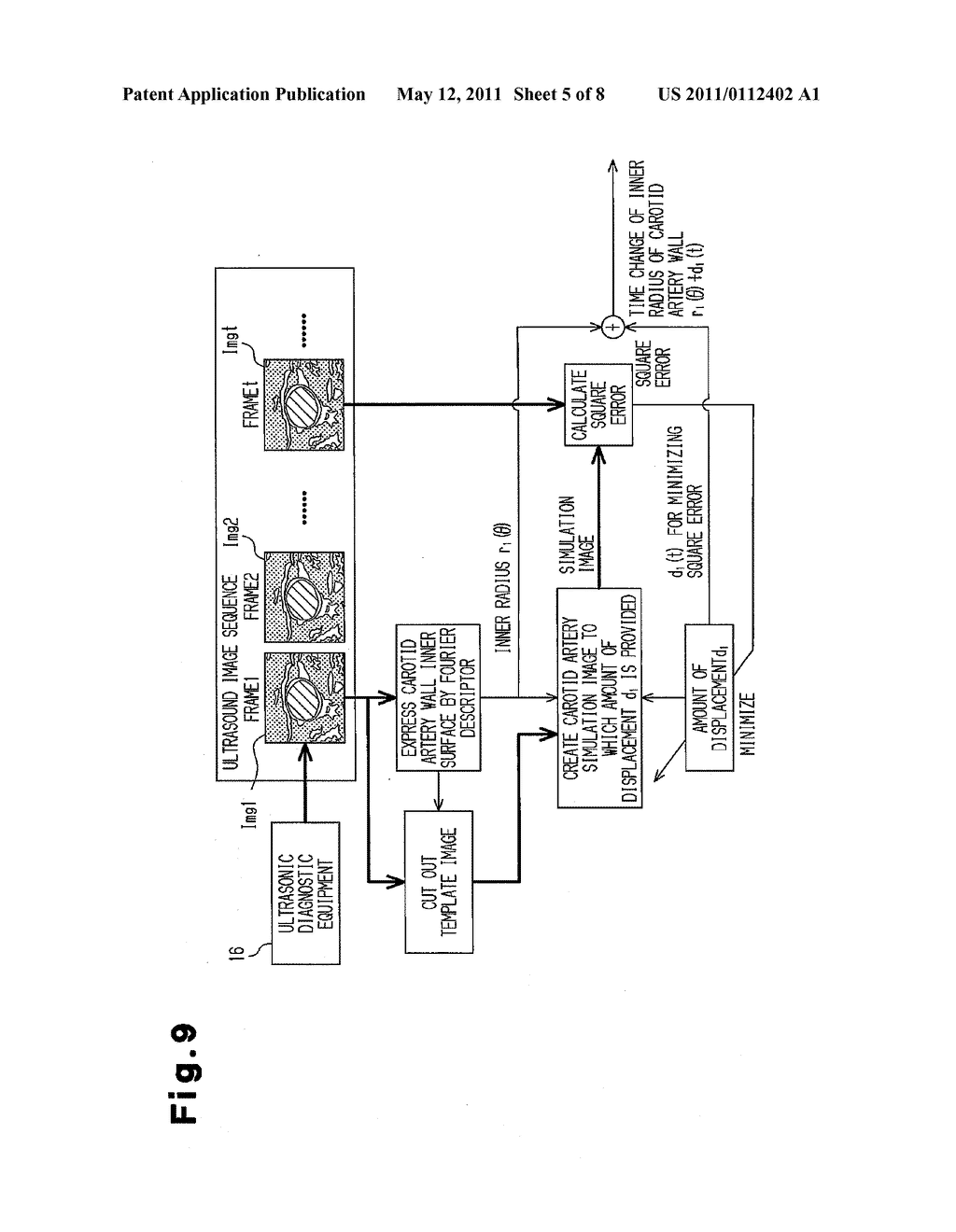 IMAGE PROCESSING APPARATUS, IMAGE PROCESSING PROGRAM, STORAGE MEDIUM AND ULTRA-SONOGRAPH - diagram, schematic, and image 06