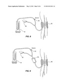 BLOOD PRESSURE MONITOR diagram and image