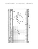 METHOD FOR AUTOMATED EKG ANALYSIS diagram and image