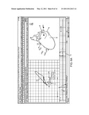 METHOD FOR AUTOMATED EKG ANALYSIS diagram and image