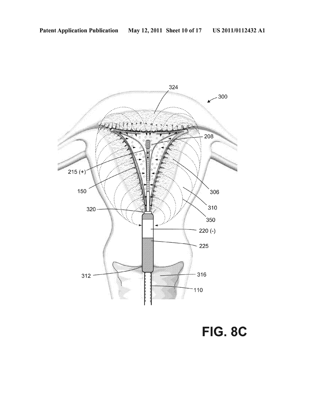 SYSTEMS AND DEVICES FOR EVALUATING THE INTEGRITY OF A UTERINE CAVITY - diagram, schematic, and image 11