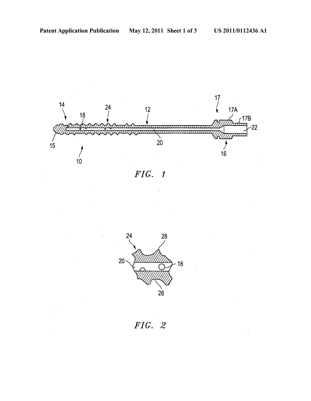 Distraction pins for fluid aspiration - diagram, schematic, and image 02