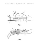 HIP TRACTION DEVICE AND METHODS diagram and image