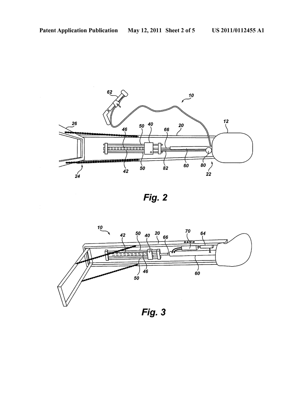 HIP TRACTION DEVICE AND METHODS - diagram, schematic, and image 03