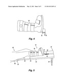 HIP TRACTION DEVICE AND METHODS diagram and image