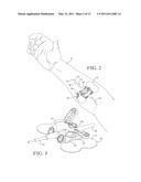 INTRAVENOUS CATHETER ANCHORING DEVICE diagram and image