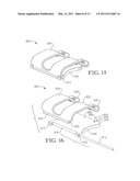 INTRAVENOUS CATHETER ANCHORING DEVICE diagram and image