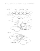 INTRAVENOUS CATHETER ANCHORING DEVICE diagram and image