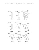 DEVICES AND METHODS FOR TREATING PAIN ASSOCIATED WITH TONSILLECTOMIES diagram and image