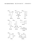 DEVICES AND METHODS FOR TREATING PAIN ASSOCIATED WITH TONSILLECTOMIES diagram and image