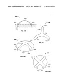 DEVICES AND METHODS FOR TREATING PAIN ASSOCIATED WITH TONSILLECTOMIES diagram and image