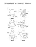 DEVICES AND METHODS FOR TREATING PAIN ASSOCIATED WITH TONSILLECTOMIES diagram and image