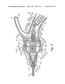 Surgical instrument diagram and image