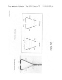 Hollow body cavity ablation apparatus diagram and image