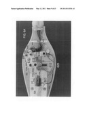 Hollow body cavity ablation apparatus diagram and image