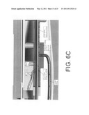 Hollow body cavity ablation apparatus diagram and image