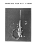 Hollow body cavity ablation apparatus diagram and image