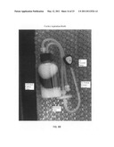 Hollow body cavity ablation apparatus diagram and image