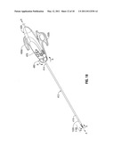 Battery Powered Electrosurgery diagram and image