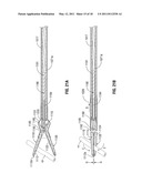 Battery Powered Electrosurgery diagram and image