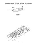 TISSUE MODIFICATION DEVICES diagram and image