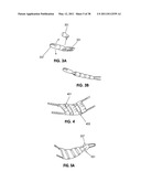 TISSUE MODIFICATION DEVICES diagram and image