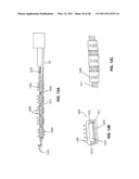 TISSUE MODIFICATION DEVICES diagram and image