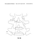 TISSUE MODIFICATION DEVICES diagram and image