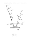 TISSUE MODIFICATION DEVICES diagram and image