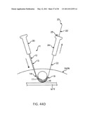 TISSUE MODIFICATION DEVICES diagram and image