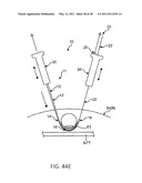 TISSUE MODIFICATION DEVICES diagram and image