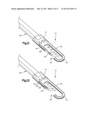 BI-DIRECTIONAL SUTURE PASSER diagram and image