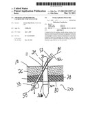 APPARATUS AND METHOD FOR LAPAROSCOPIC PORT SITE SUTURE diagram and image