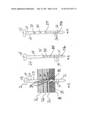 APPARATUS AND METHOD FOR LAPAROSCOPIC PORT SITE SUTURE diagram and image