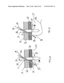 APPARATUS AND METHOD FOR LAPAROSCOPIC PORT SITE SUTURE diagram and image