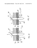 APPARATUS AND METHOD FOR LAPAROSCOPIC PORT SITE SUTURE diagram and image