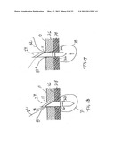 APPARATUS AND METHOD FOR LAPAROSCOPIC PORT SITE SUTURE diagram and image