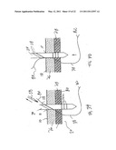 APPARATUS AND METHOD FOR LAPAROSCOPIC PORT SITE SUTURE diagram and image