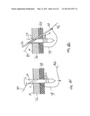 APPARATUS AND METHOD FOR LAPAROSCOPIC PORT SITE SUTURE diagram and image