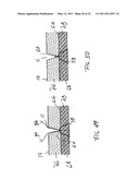 APPARATUS AND METHOD FOR LAPAROSCOPIC PORT SITE SUTURE diagram and image