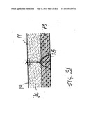 APPARATUS AND METHOD FOR LAPAROSCOPIC PORT SITE SUTURE diagram and image